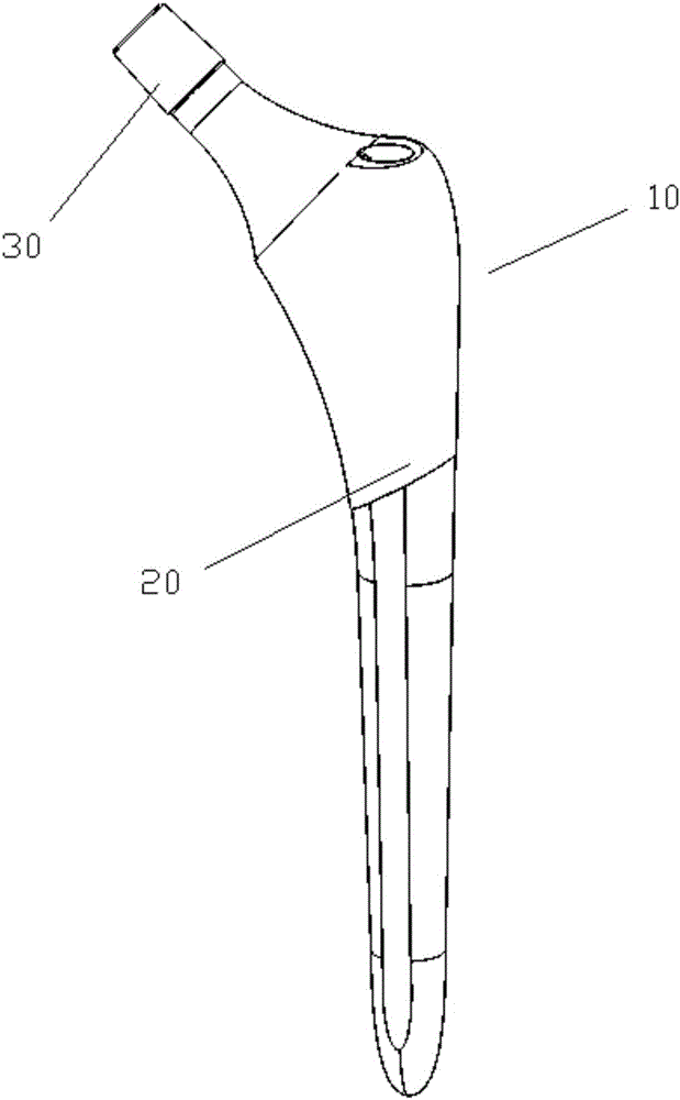 A prosthesis structure
