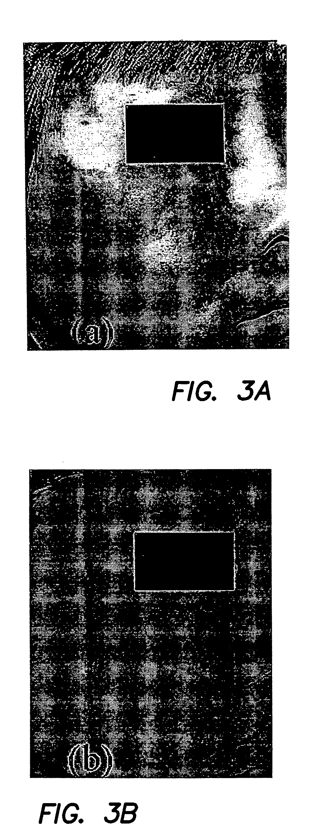 Method and apparatus for characterization of chromophore content and distribution in skin using cross-polarized diffuse reflectance imaging