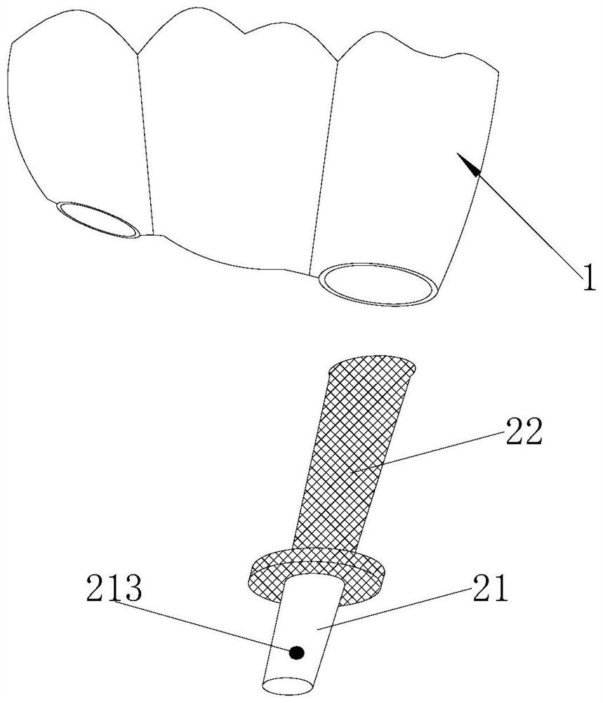 Implant upper part repair pre-bonded abutment replica and preparation method thereof