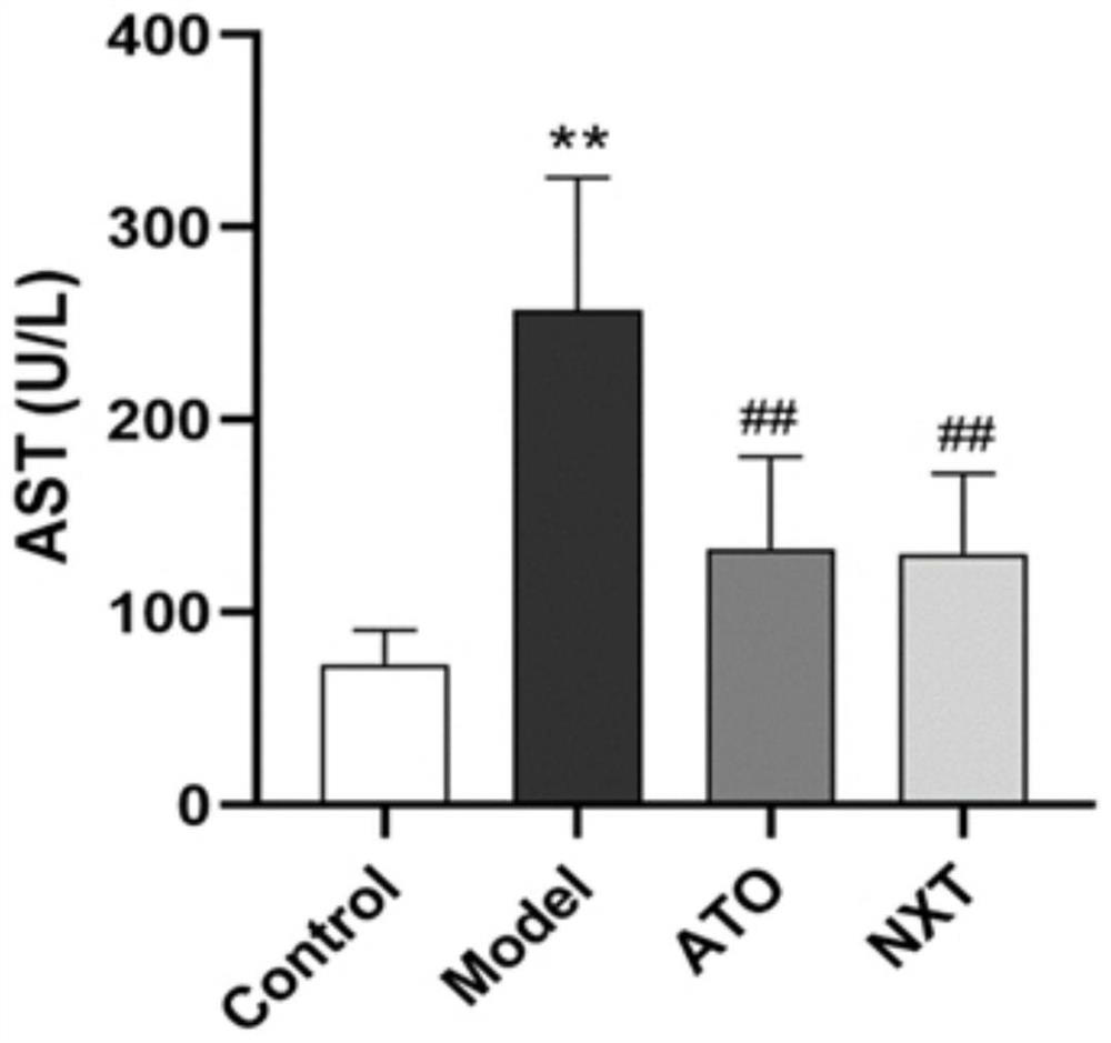 Application of Naoxintong preparation in preparation of medicine for treating non-alcoholic fatty liver disease