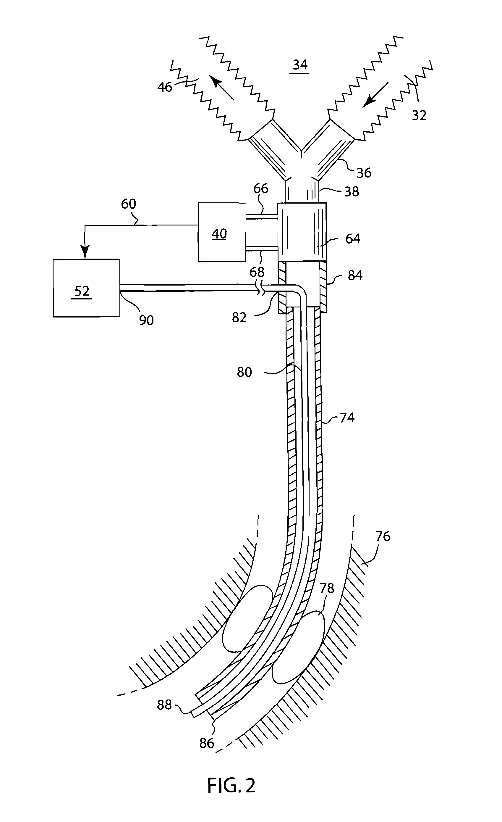 Method and apparatus for airway compensation control