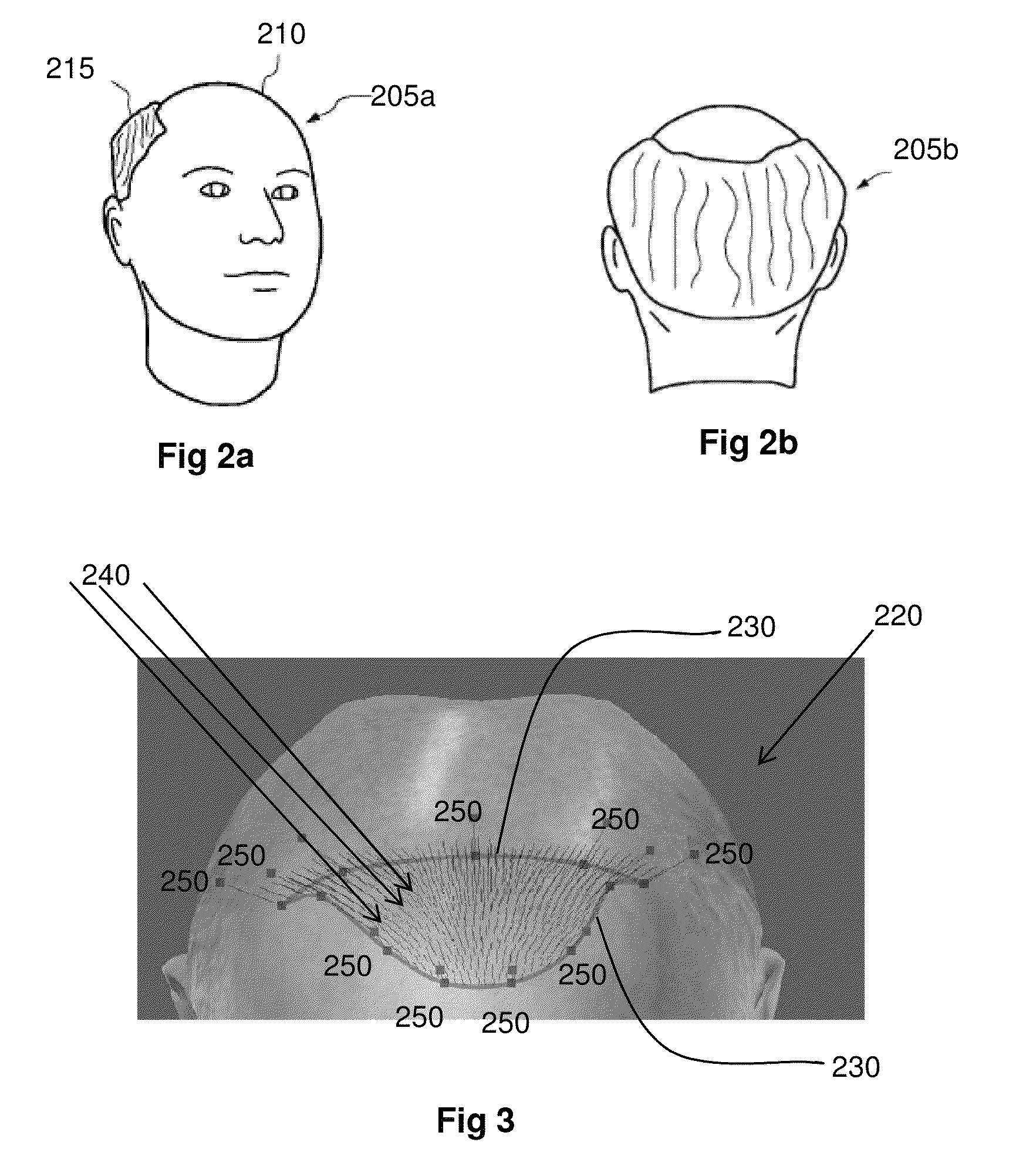 Systems and methods for planning hair transplantation