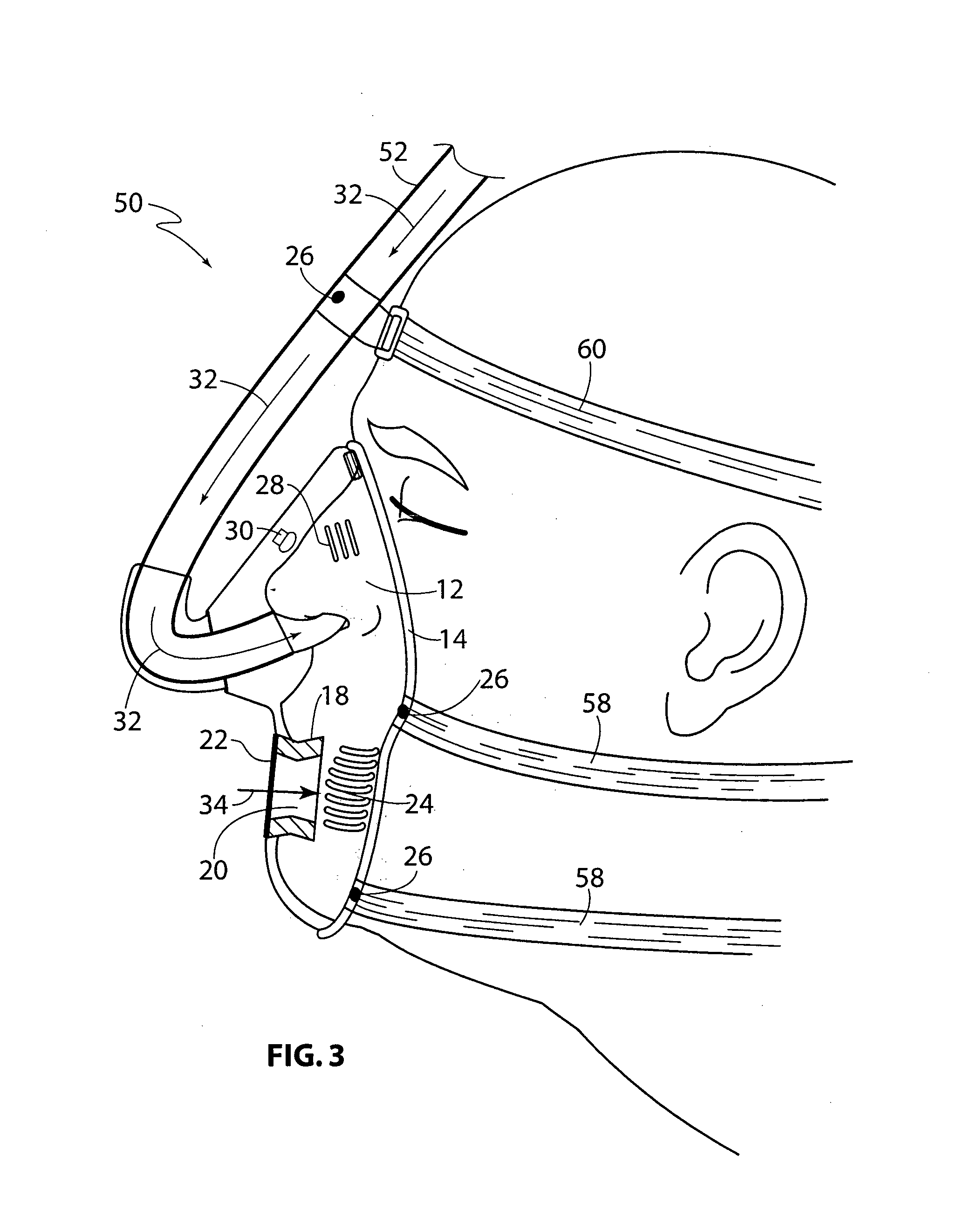 Mask for use with a patient undergoing a sedated endoscopic procedure