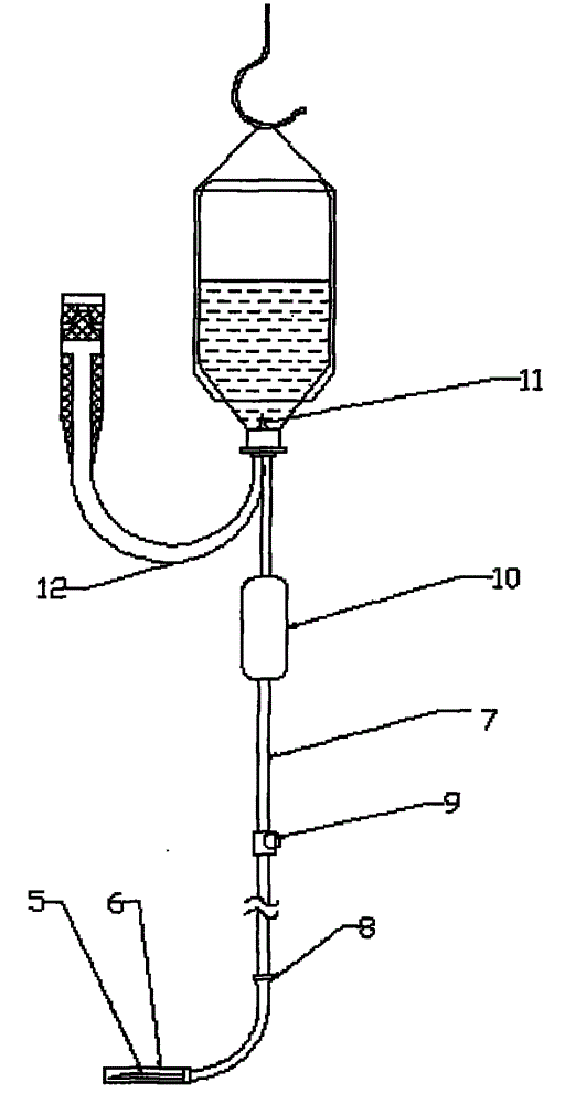 Rapid infusion device