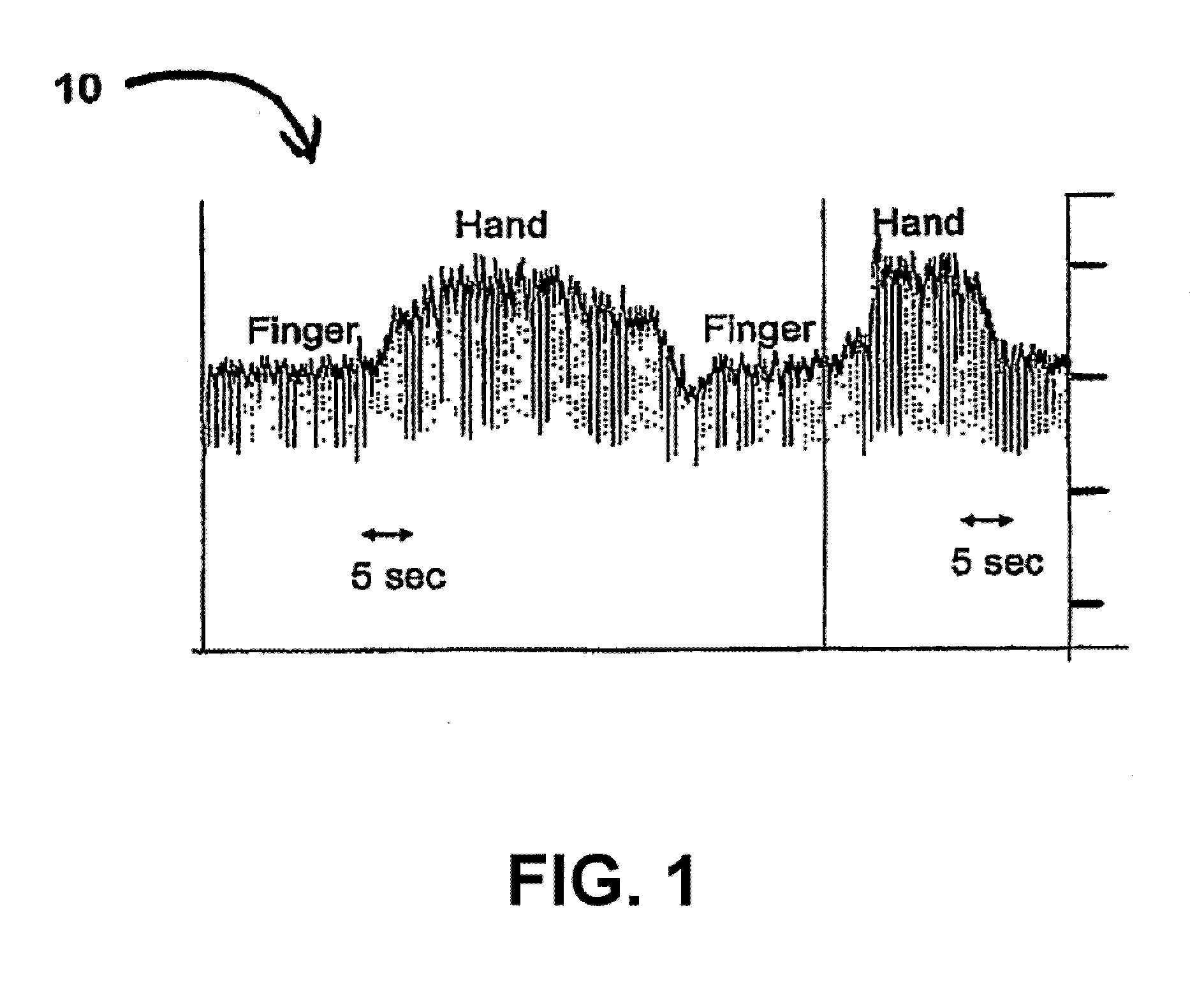 Systems and methods for placing heart leads