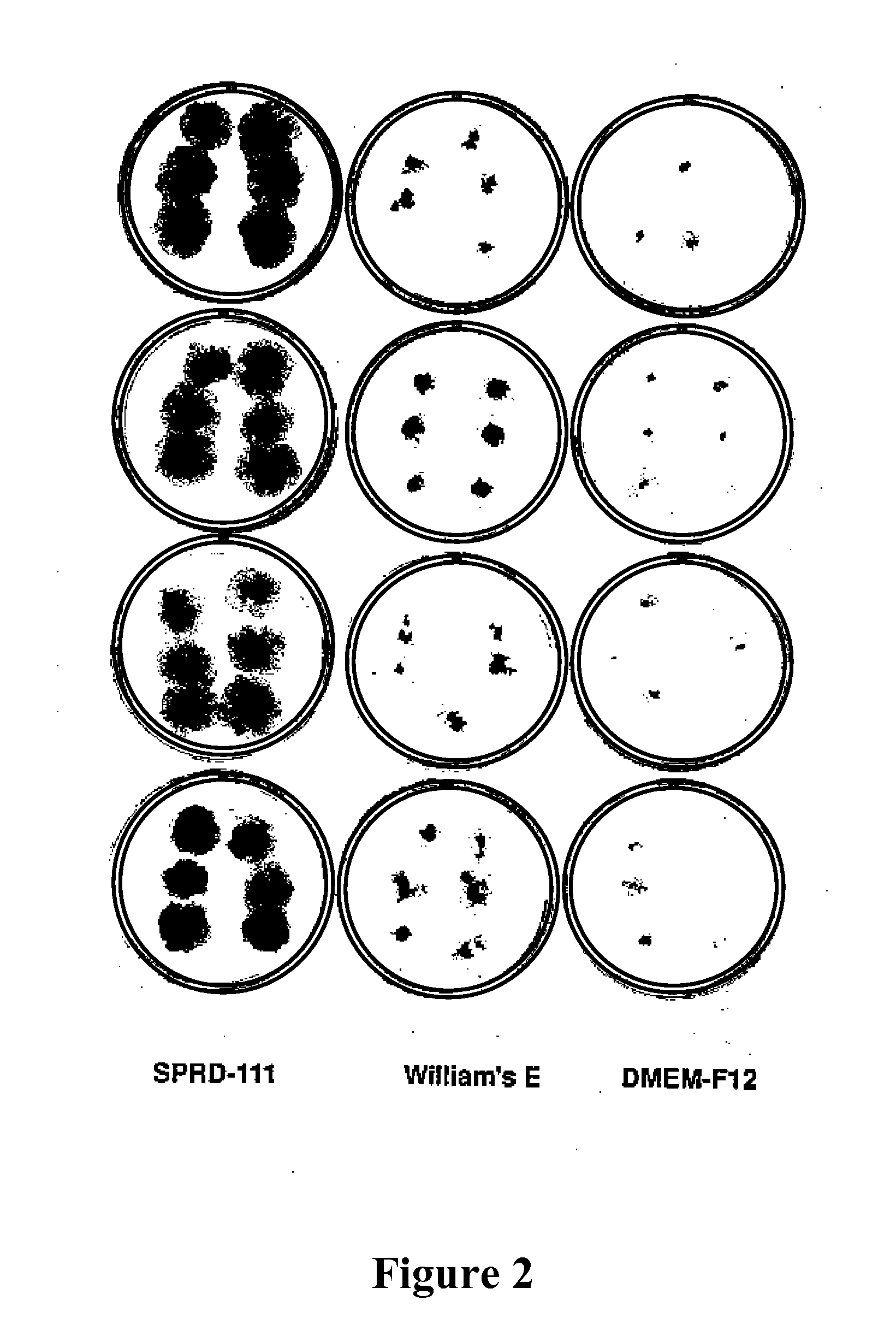 Culture Media For Expansion and Differentiation of Epidermal Cells and Uses Thereof For In Vitro Growth of Hair Follicles