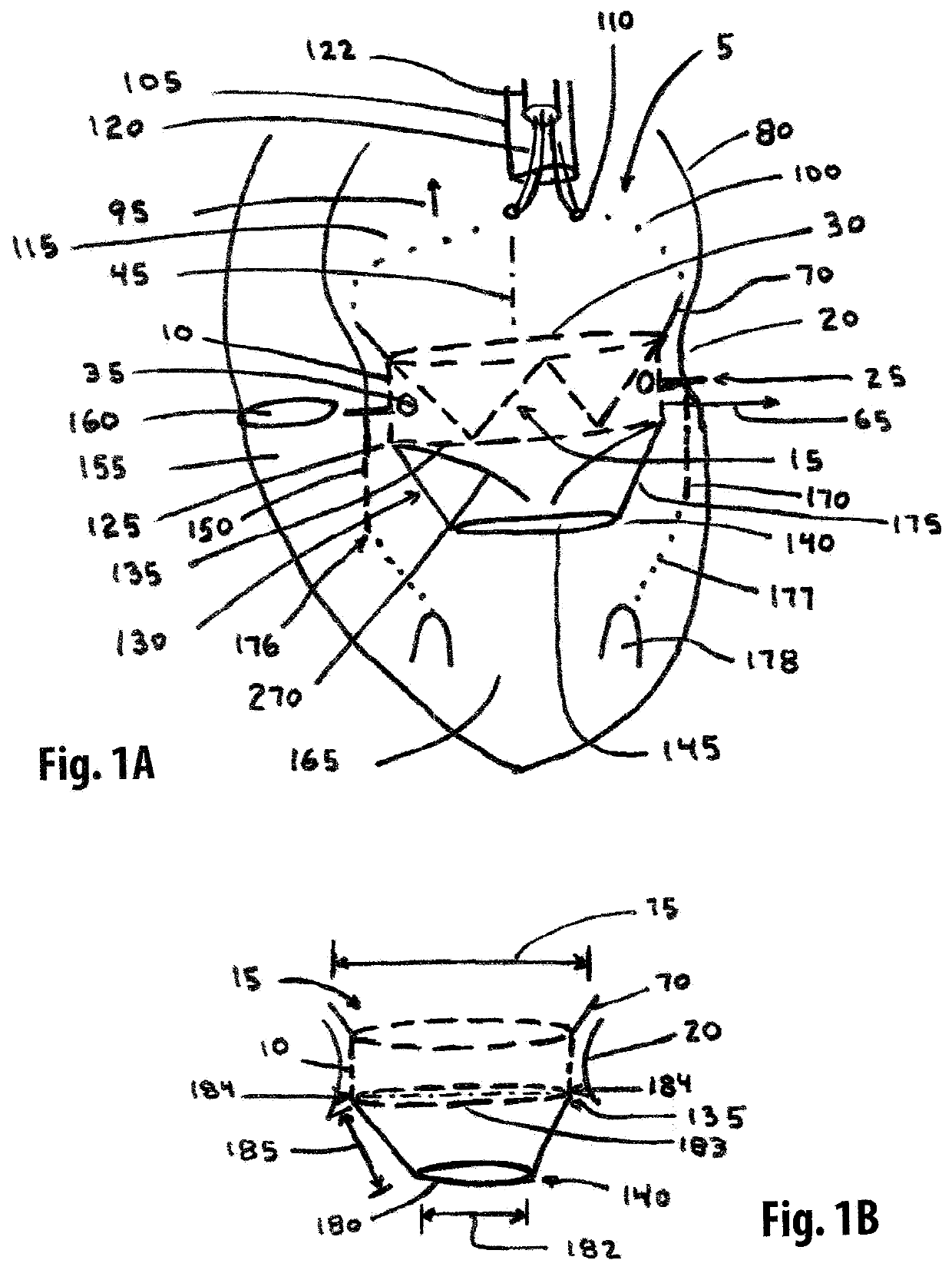 Straddle annular mitral valve