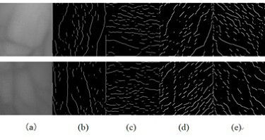 Vein image enhancement method based on maximum curvature method and multi-scale Hessian matrix