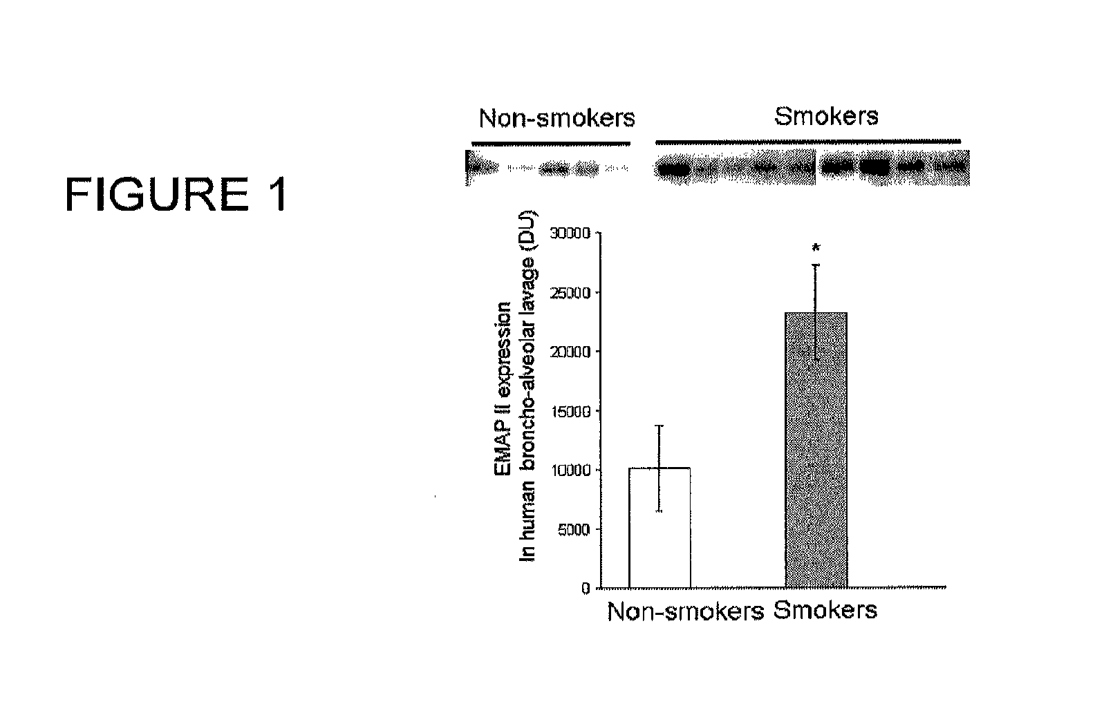 Method for diagnosing and treating emphysema