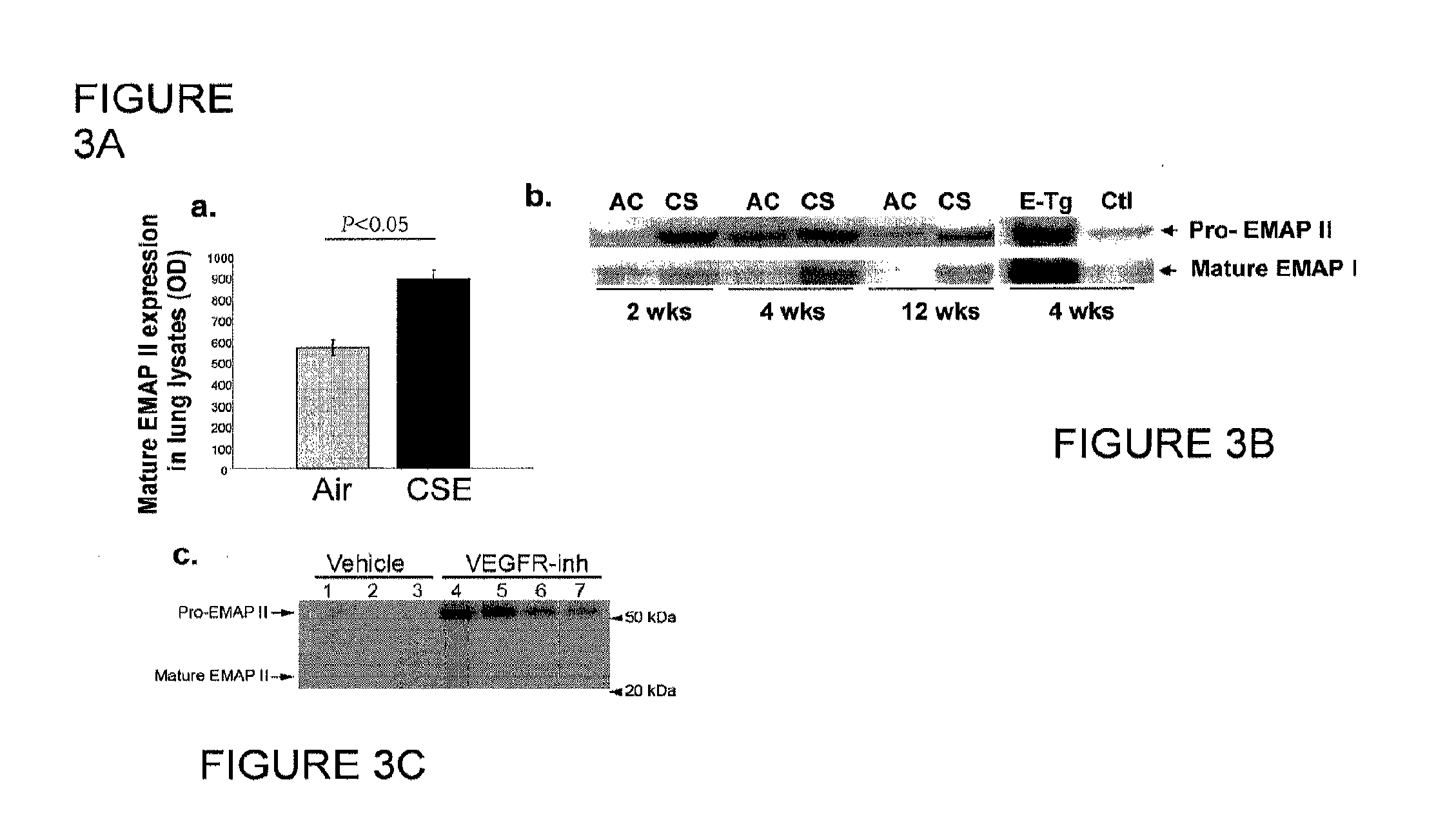 Method for diagnosing and treating emphysema