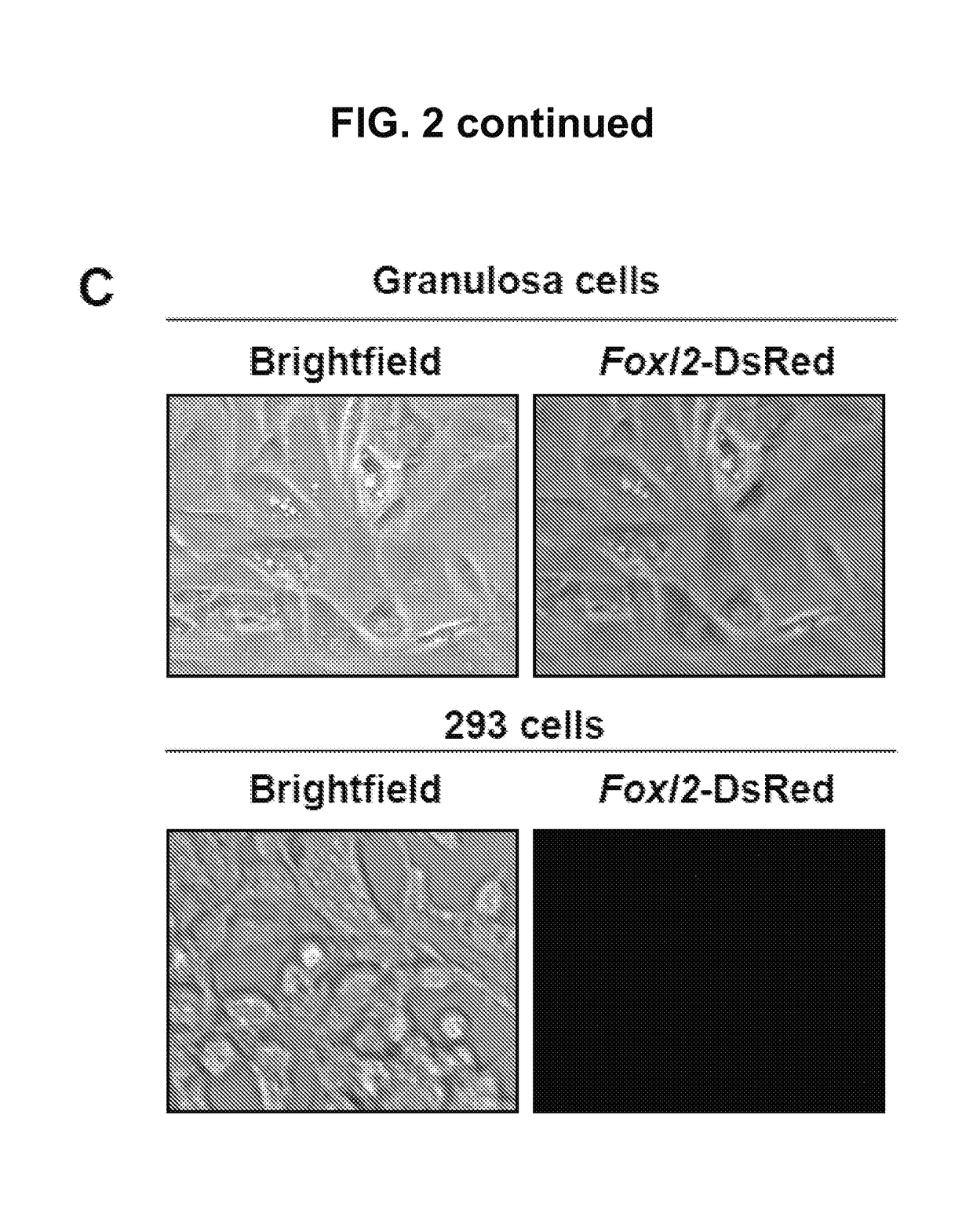 Methods for growth and maturation of ovarian follicles