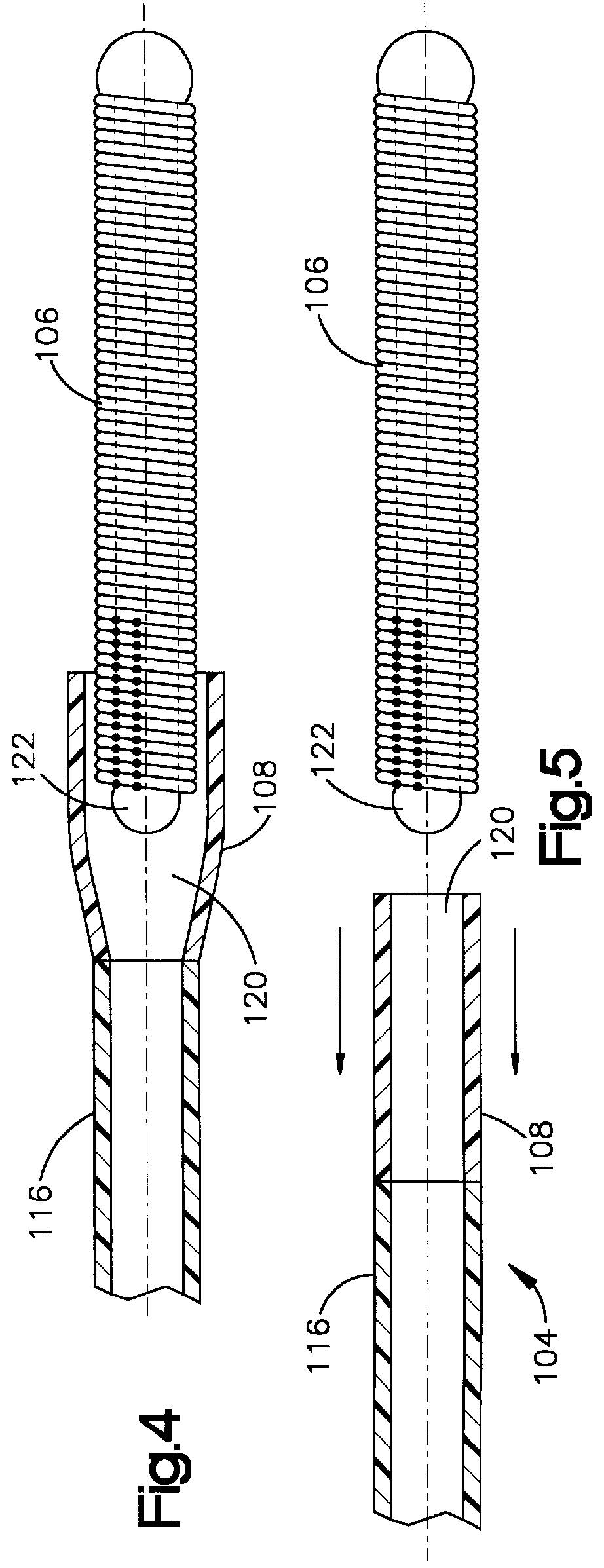 Embolic coil deployment system with improved embolic coil