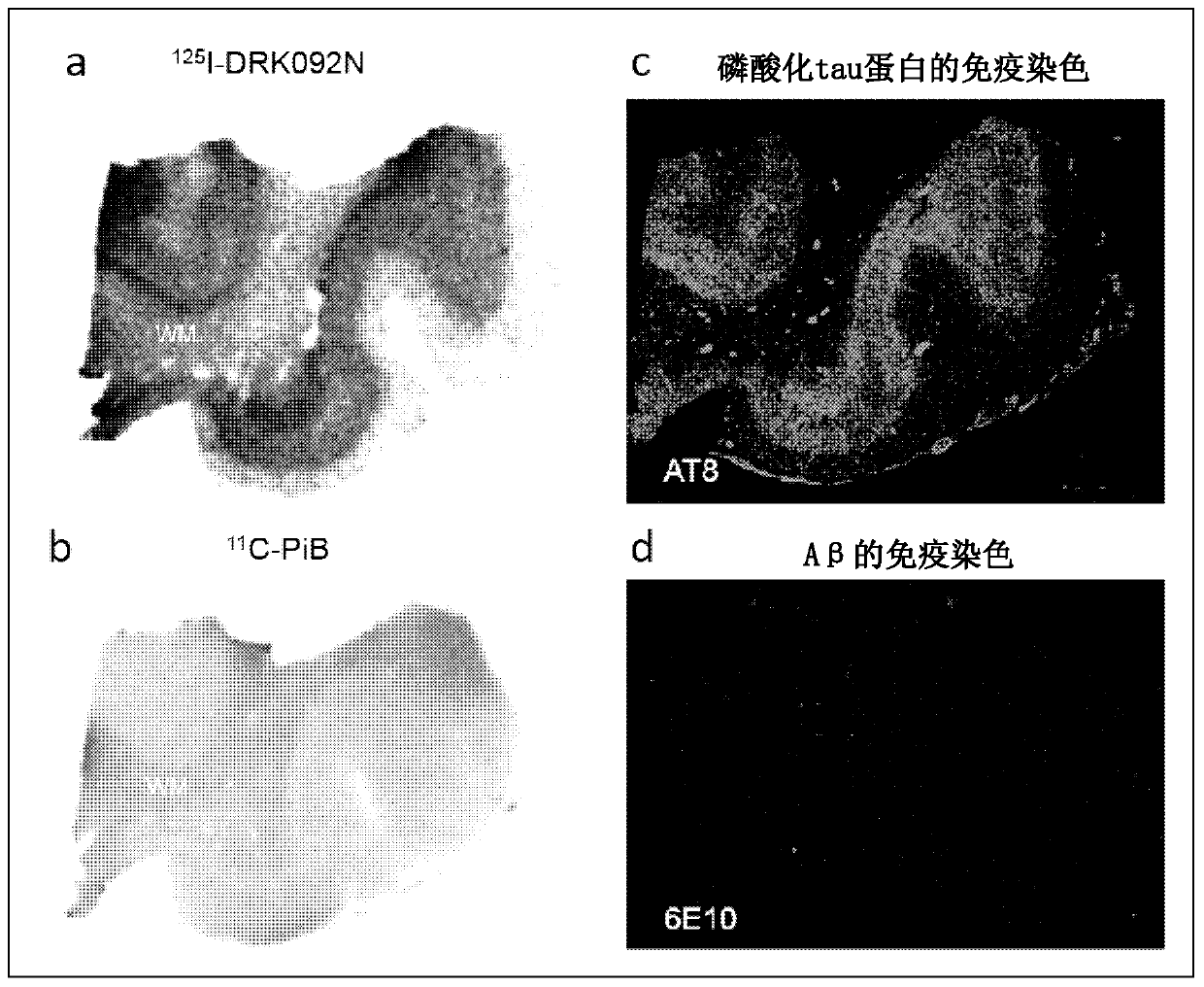 Radionuclide-labeled compound and imaging agent containing same