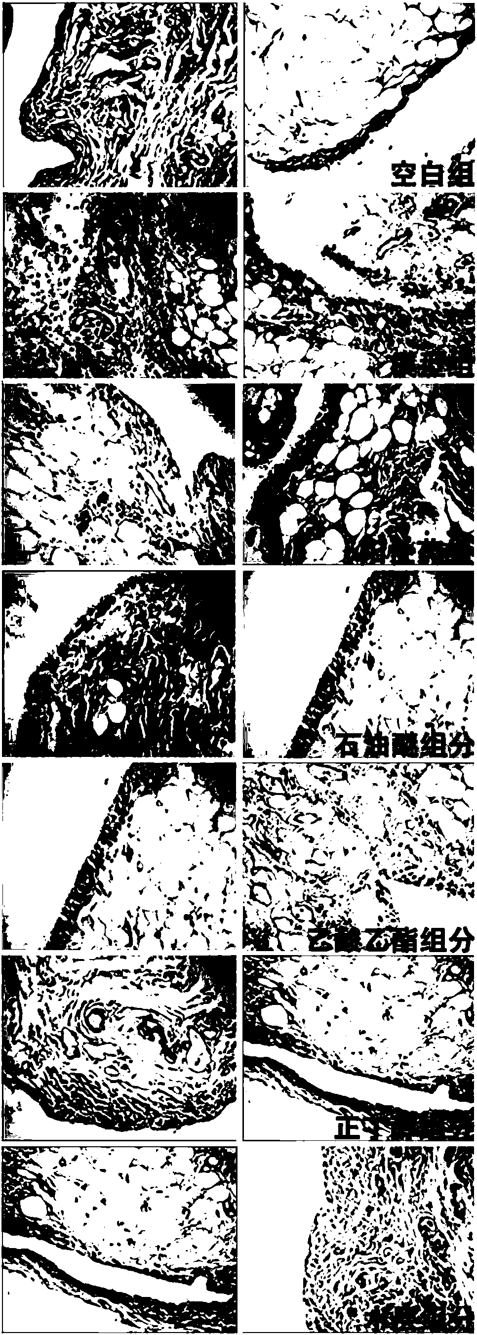 Preparation method and medicinal use of thiazide compound in Siberian Cocklour Fruit