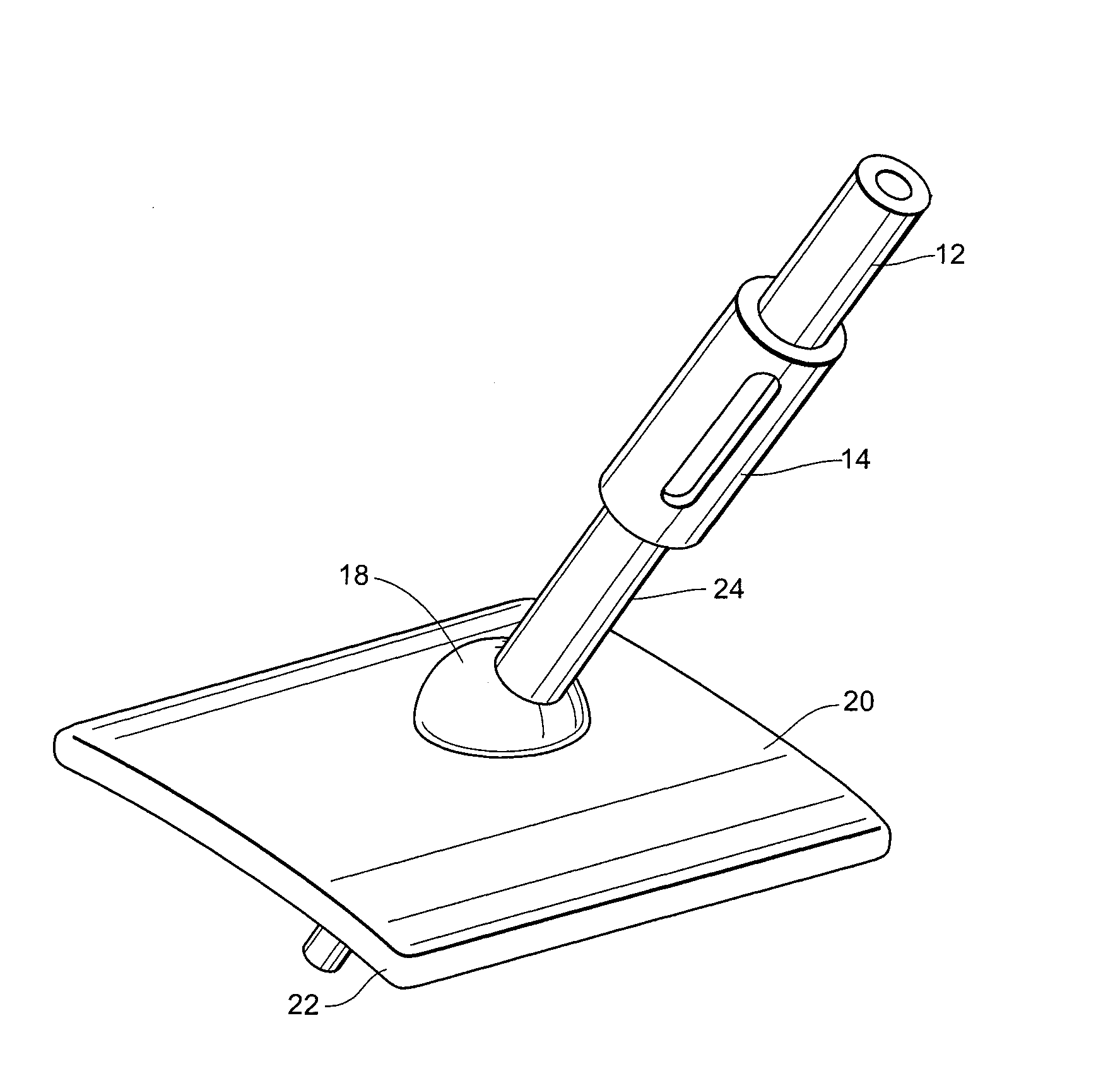 Anchorless Non-Invasive Force Dissipation System for Orthopedic Instrumentation