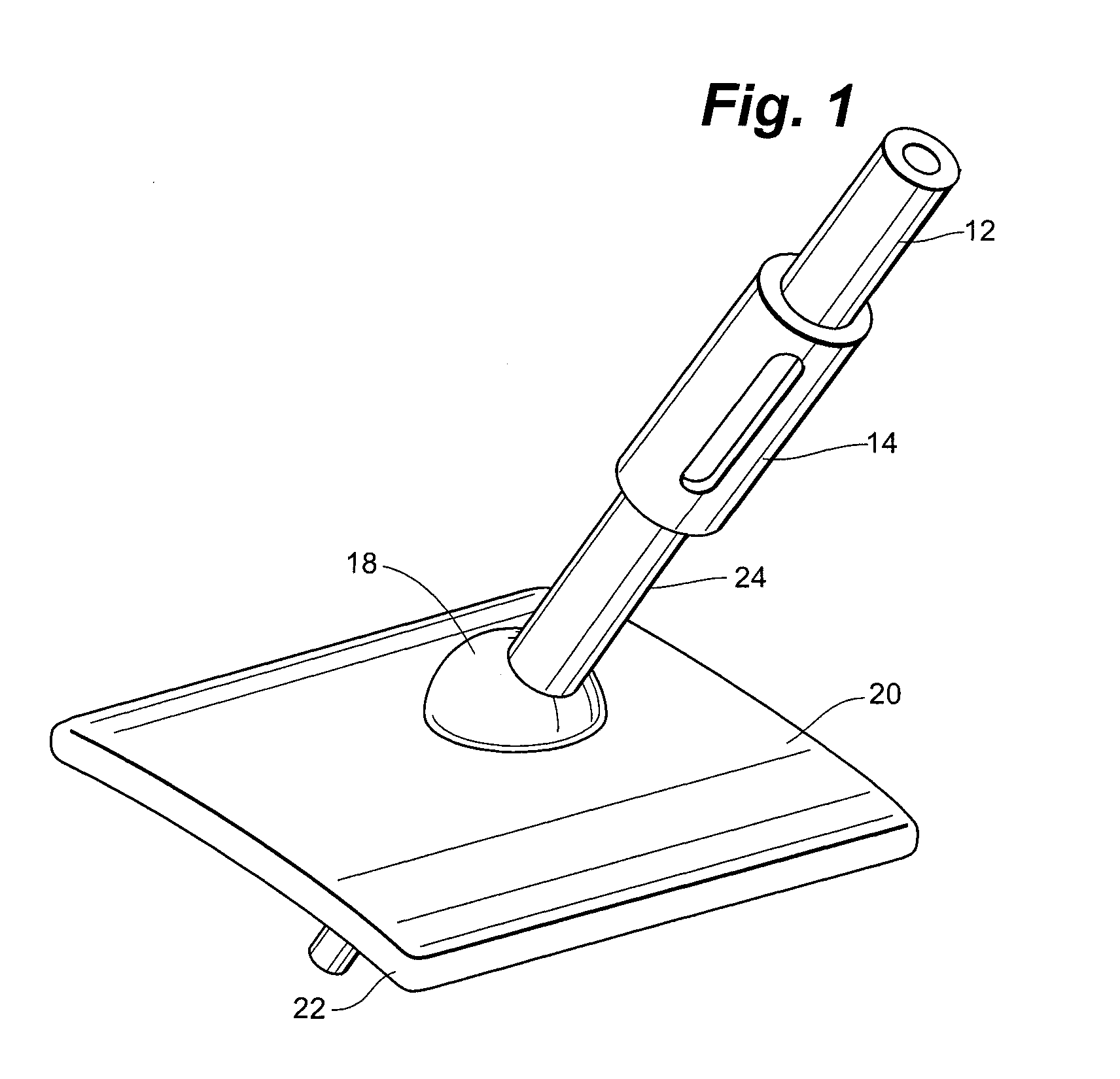 Anchorless Non-Invasive Force Dissipation System for Orthopedic Instrumentation