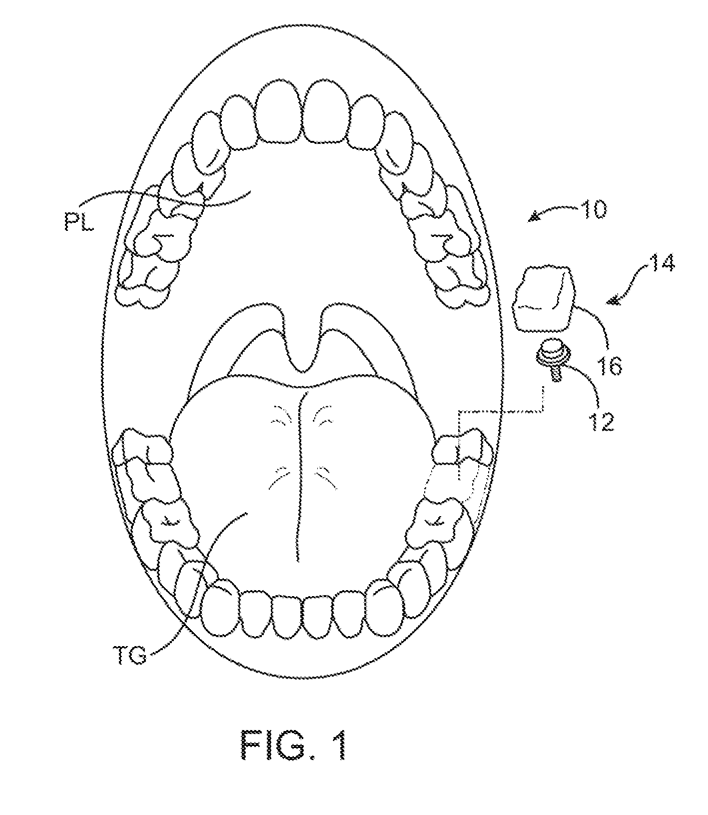 Methods and apparatus for transmitting vibrations