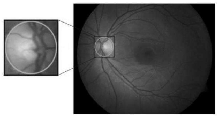 Optic disc positioning method and system in fundus image based on best sibling similarity