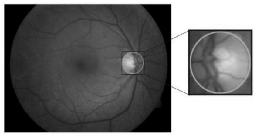 Optic disc positioning method and system in fundus image based on best sibling similarity