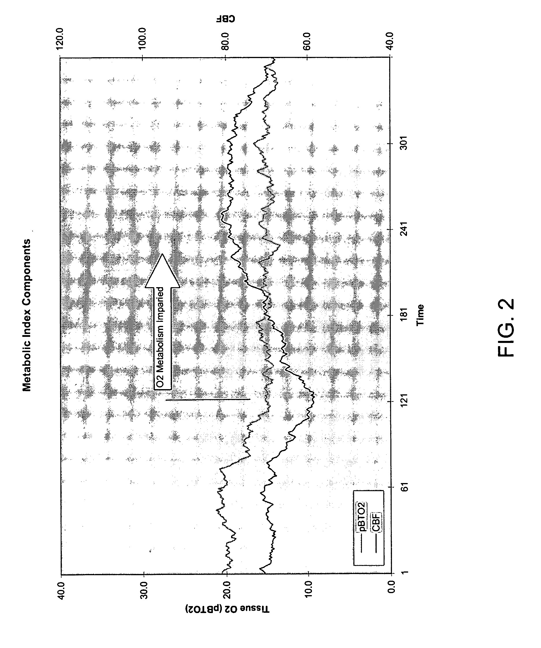 Neuromonitoring system