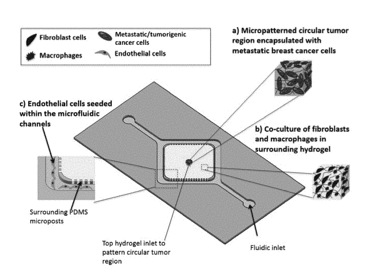 Engineering of a Novel Breast Tumor Microenvironment on a Microfluidic Chip