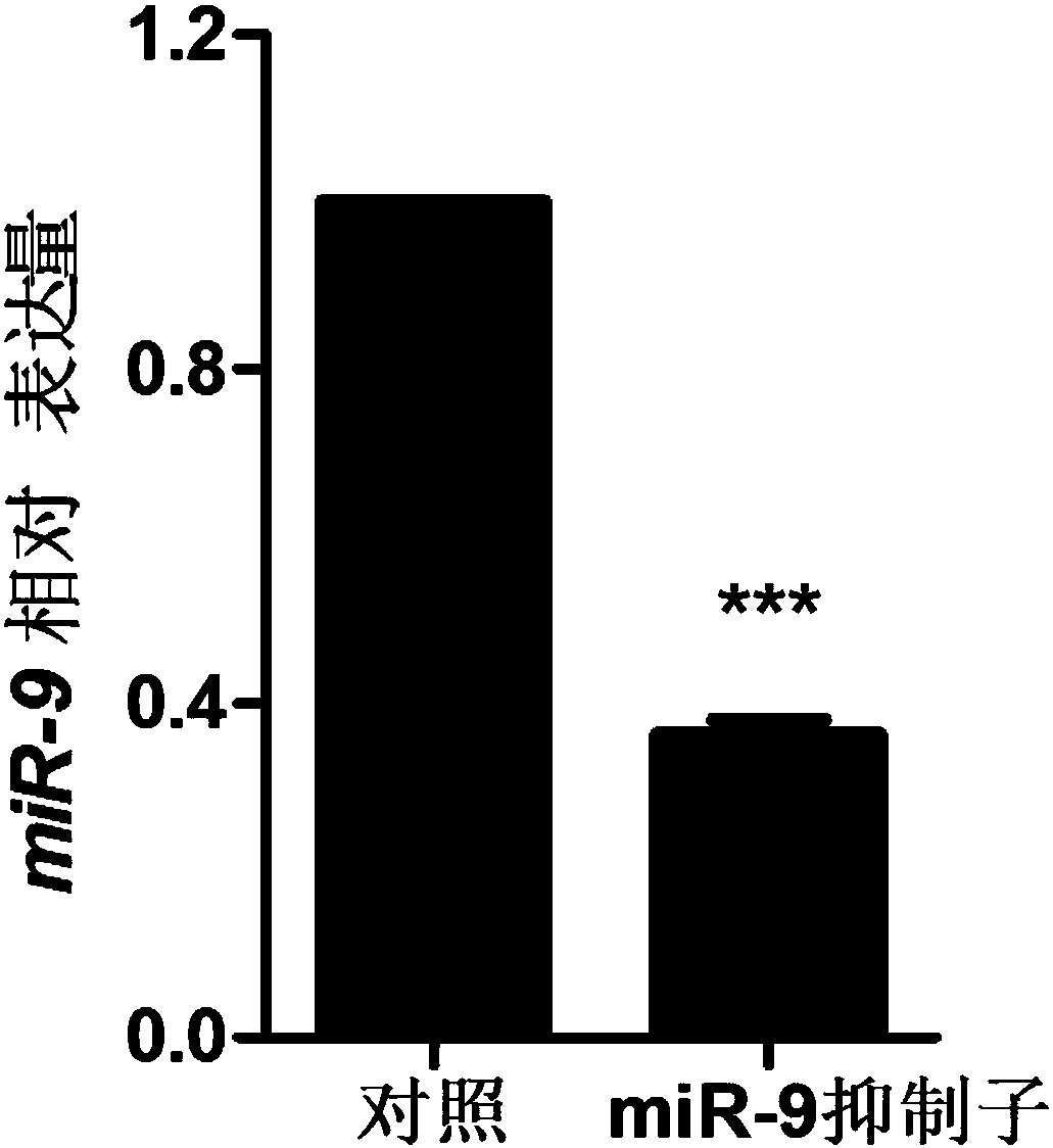 Application of miRNA repressor in preparing drug for preventing and controlling myocardial infarction