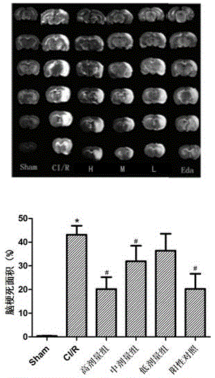 Application of frankincense extract in prevention and treatment of cardiovascular and cerebrovascular or liver and kidney damage