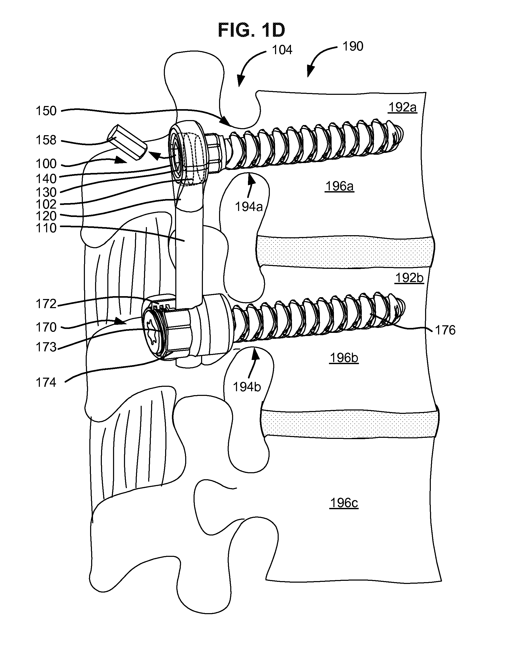 Adaptive spinal rod and methods for stabilization of the spine