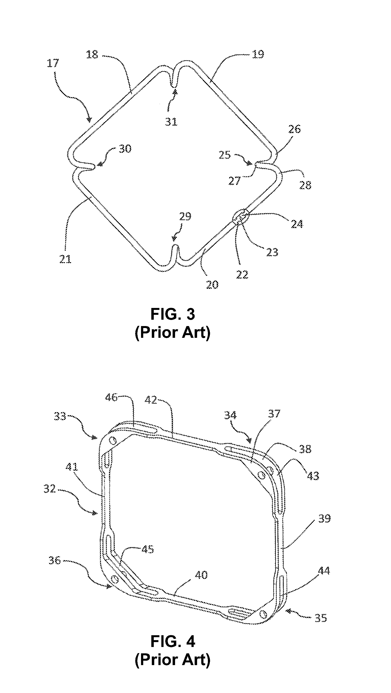 Pupil expansion device