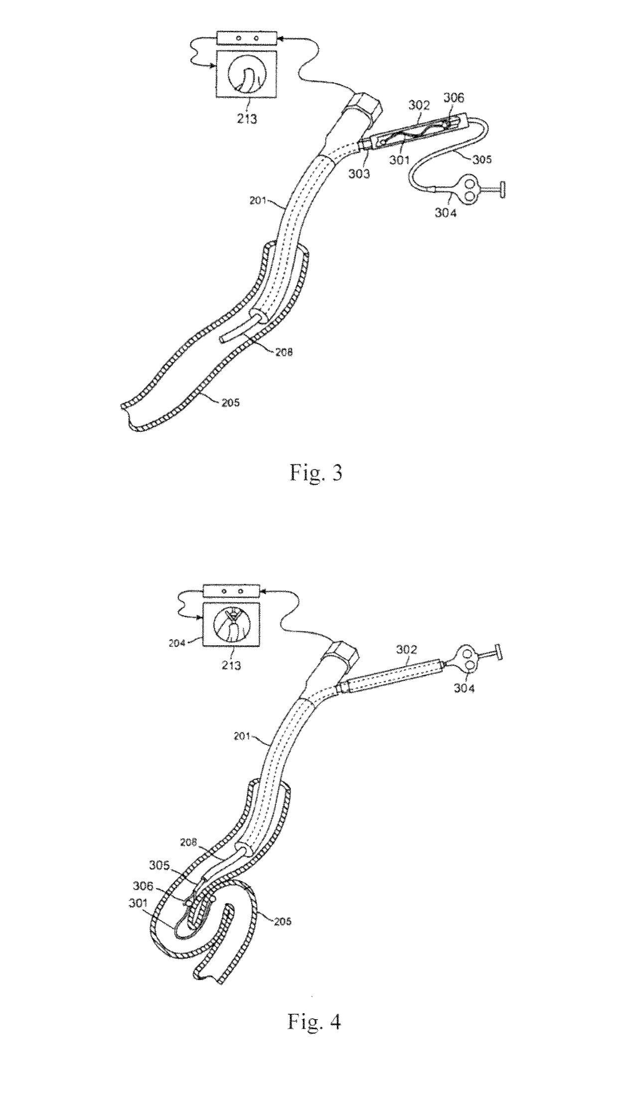 Lung volume-reducing elastic implant and instrument