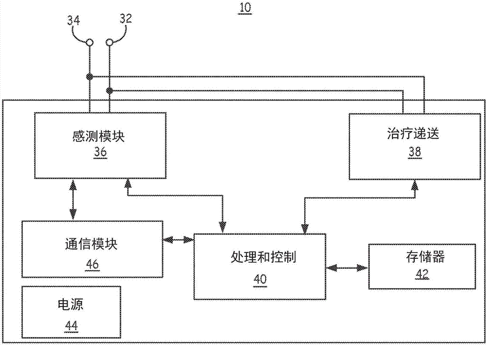 Apparatus for identifying sick sinus syndrome in an implantable cardiac monitoring device