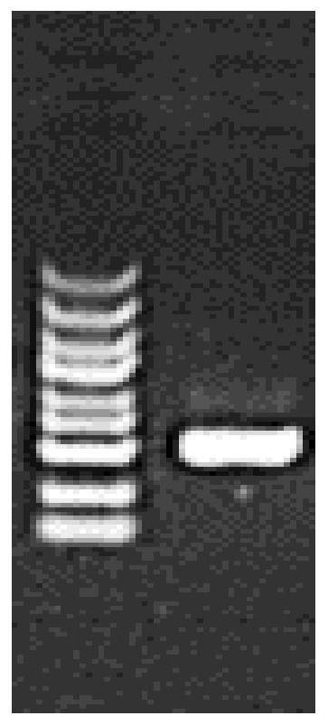 Method for overexpression of IL-15 in porcine skeletal muscle myoblasts and application thereof