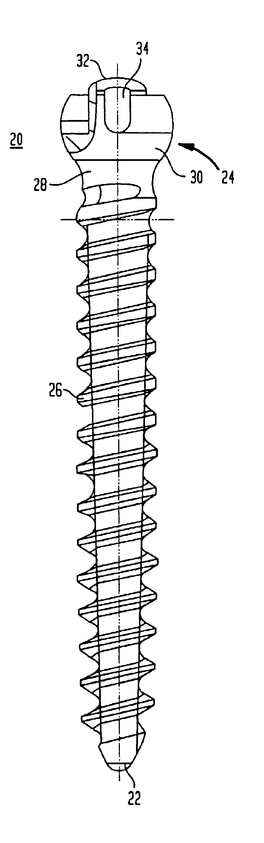 Pedicle screw assembly and methods therefor