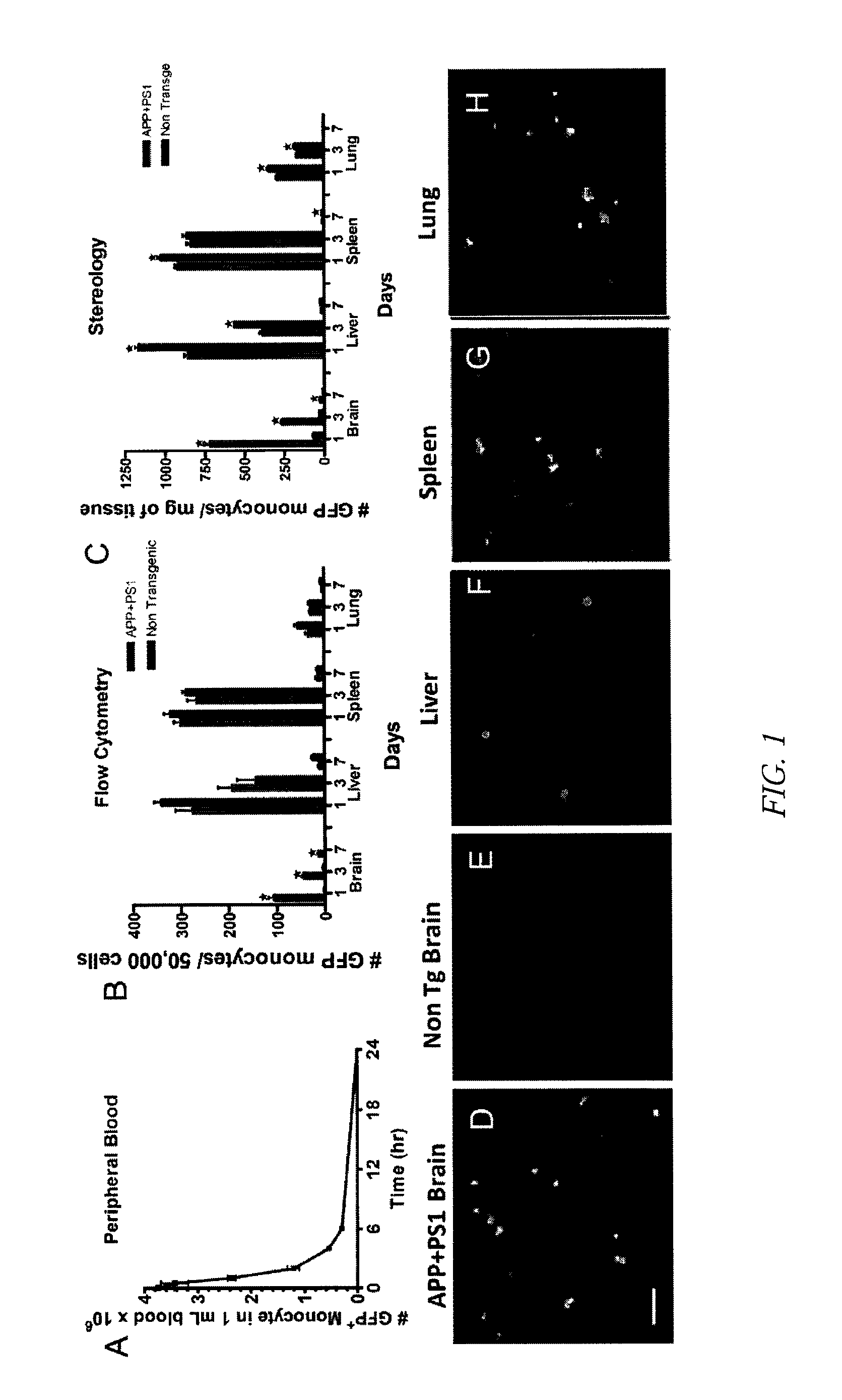 Monocytes as a gene delivery vector for secreted proteins to treat Alzheimer'S disease