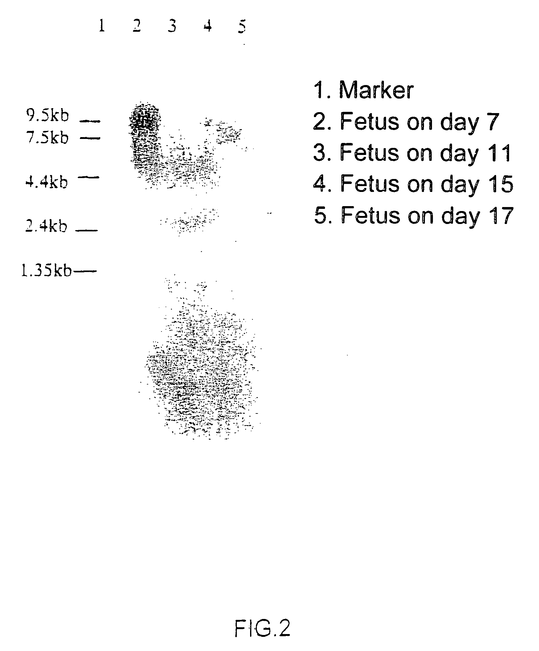 Novel protein having an egf-like repeat sequence