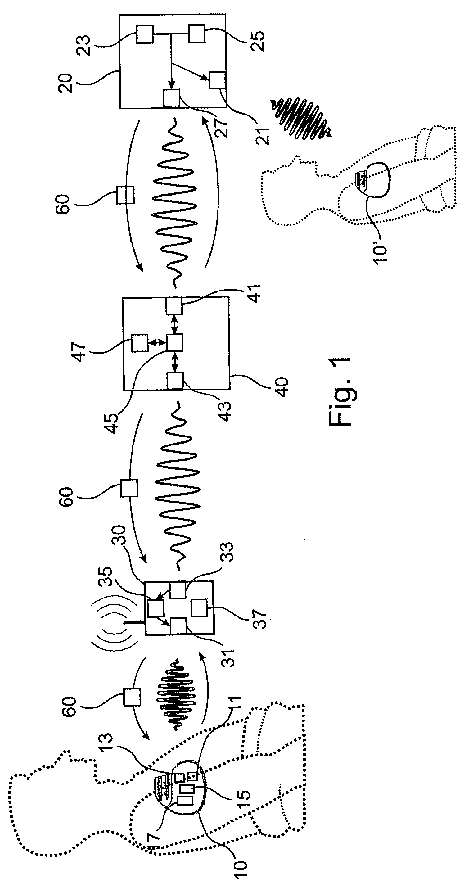 Method for secure reprogramming of clinically relevant parameters as part of remote programming of an electronic implant