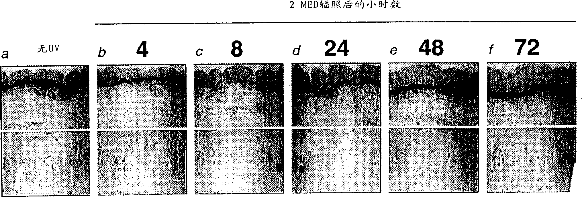 Methods and compositions for reducing UV-induced inhibition of collagen synthesis in human skin