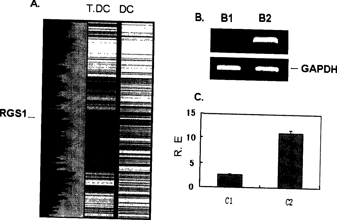 Method for screening of immunological tolerance associated disease gene RGS1 based on immunological tolerance dendritic cell