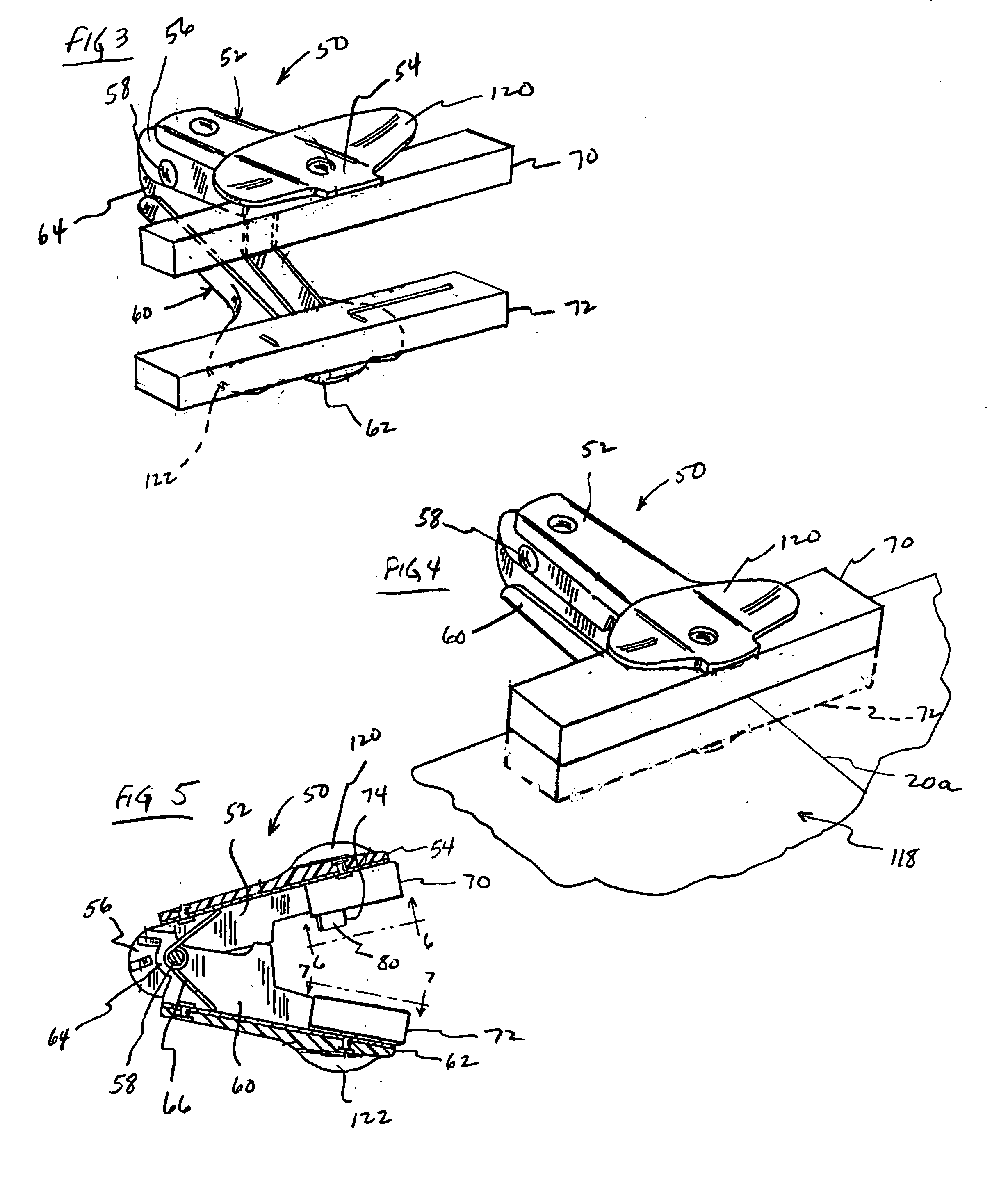 Card brace forming apparatus