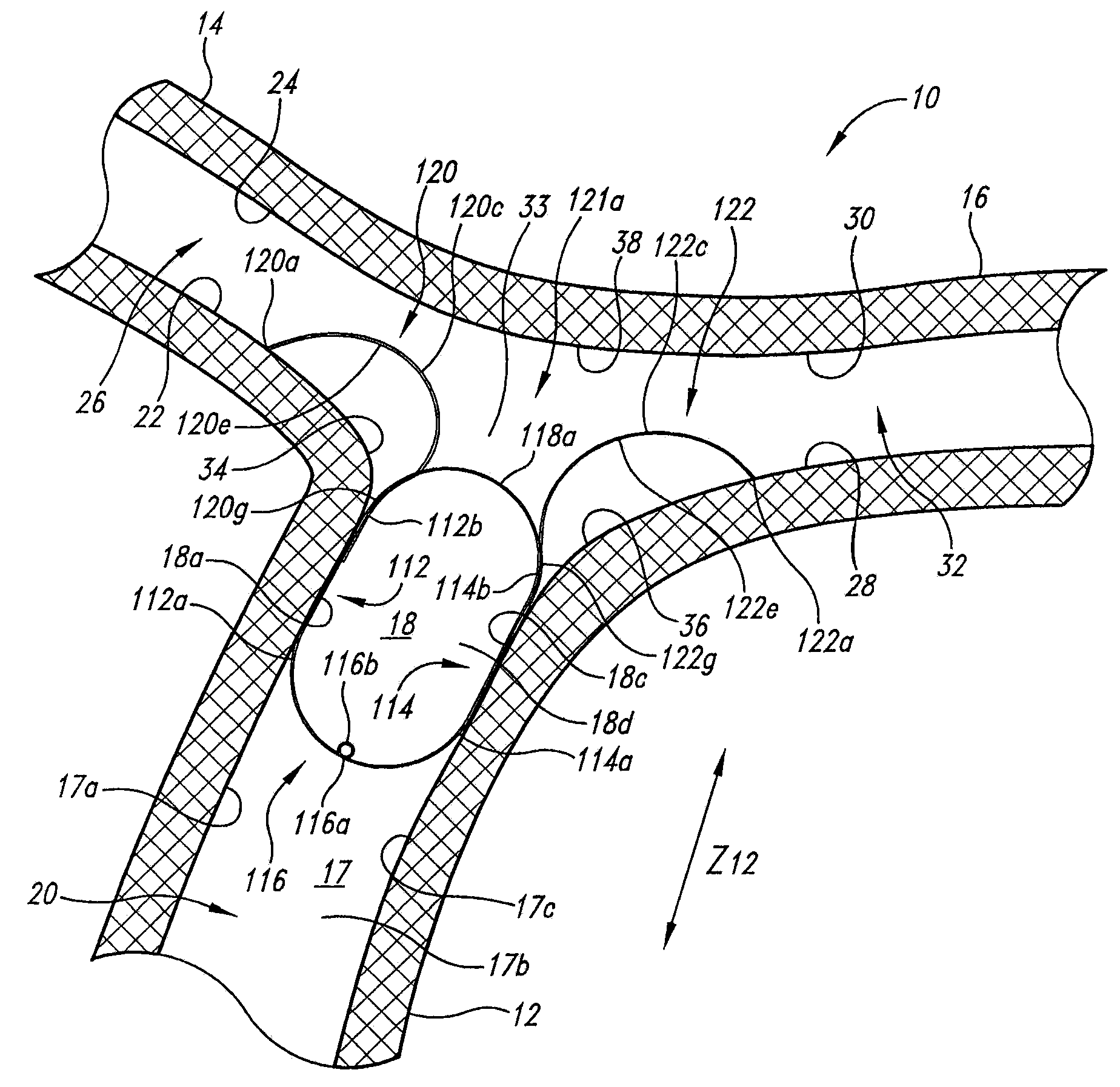 Vascular anchoring system and method