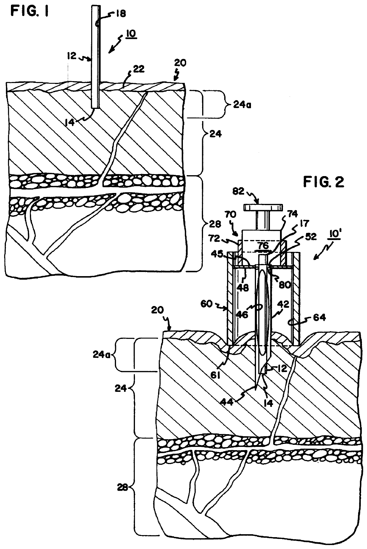 Interstitial fluid collection and constituent measurement