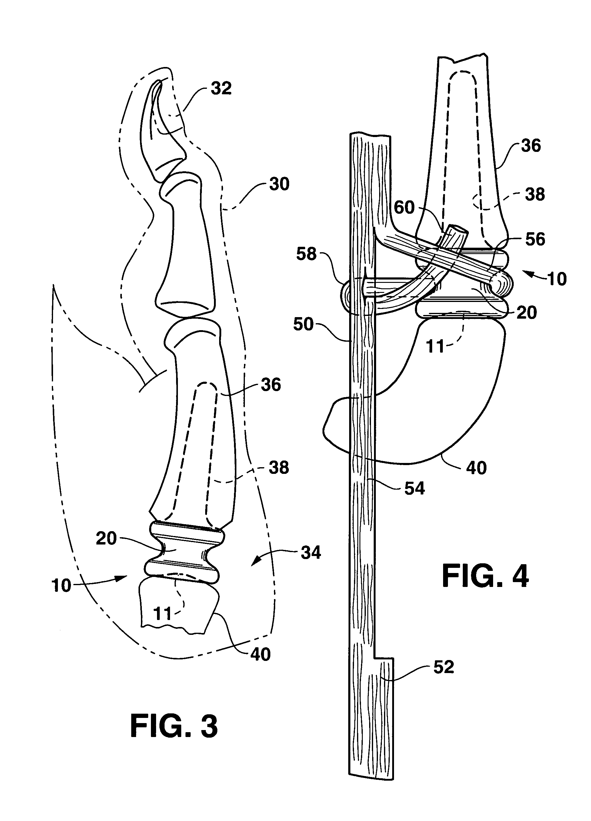 Trapezium implant for thumb and method