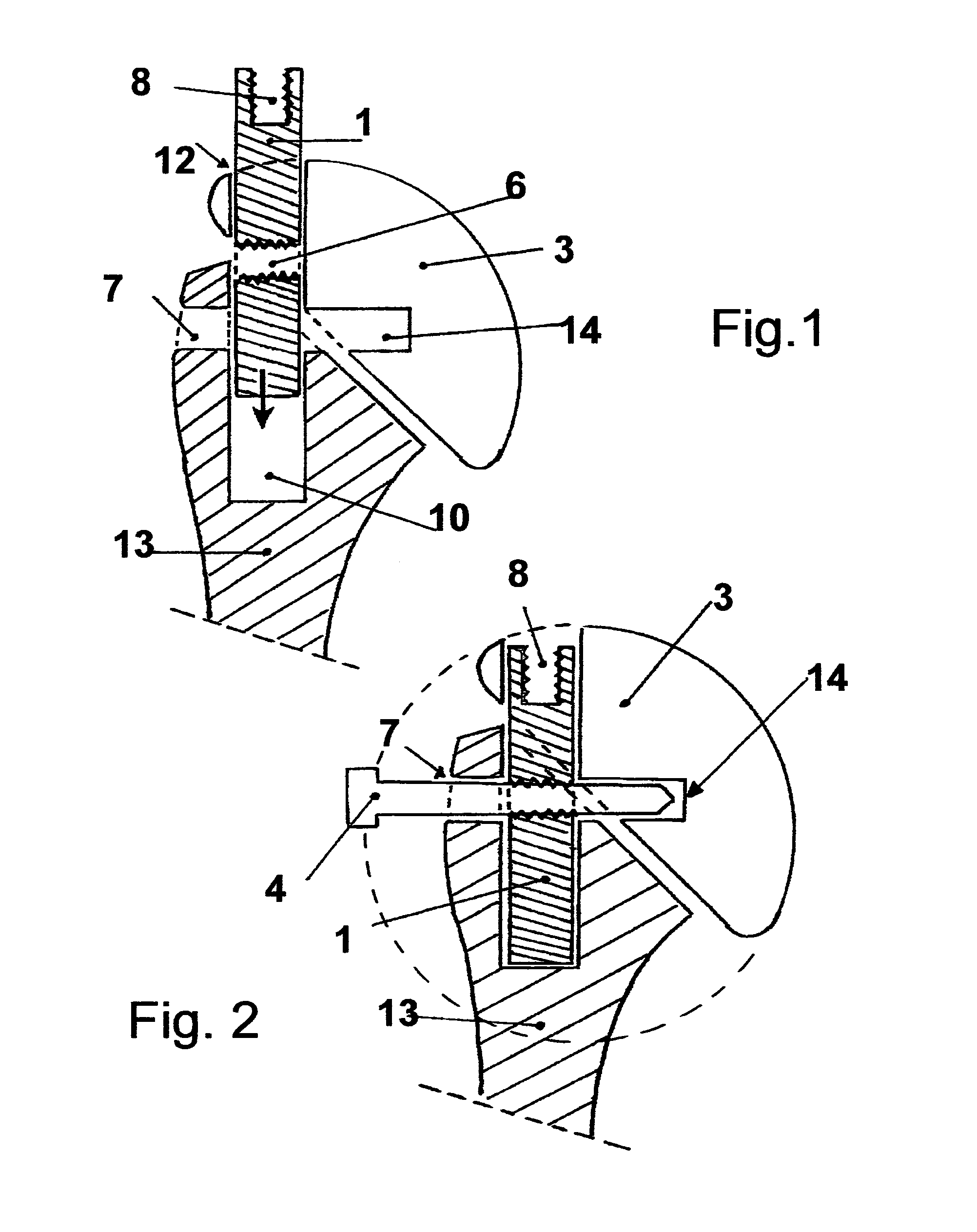 Shoulder prosthesis with insert for locking screws