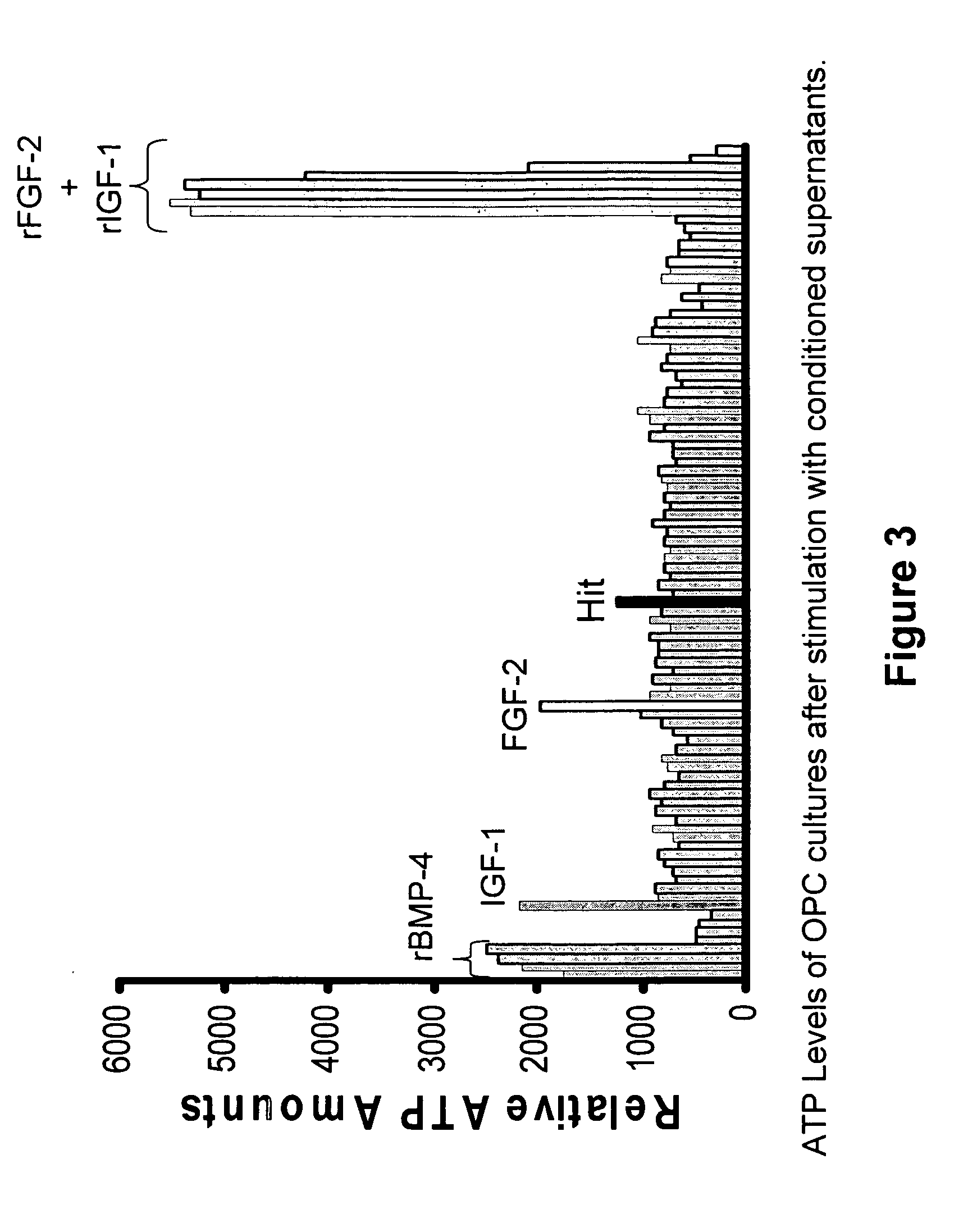 Compositions and Methods for Treating Diseases, Disorders, or Conditions Characterized by Myelin Degeneration, Myelin Deficiency or Loss