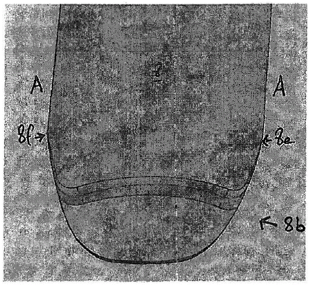 Endoscopy device