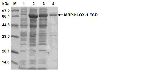 Efficient soluble expression and purification method of human LOX-1 (lectin like oxidized low density lipoprotein receptor-1) extracellular domain