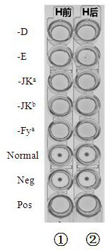 A kind of pool-checking red blood cell blood group irregular antibody detection kit based on solid-phase agglutination technology and preparation method