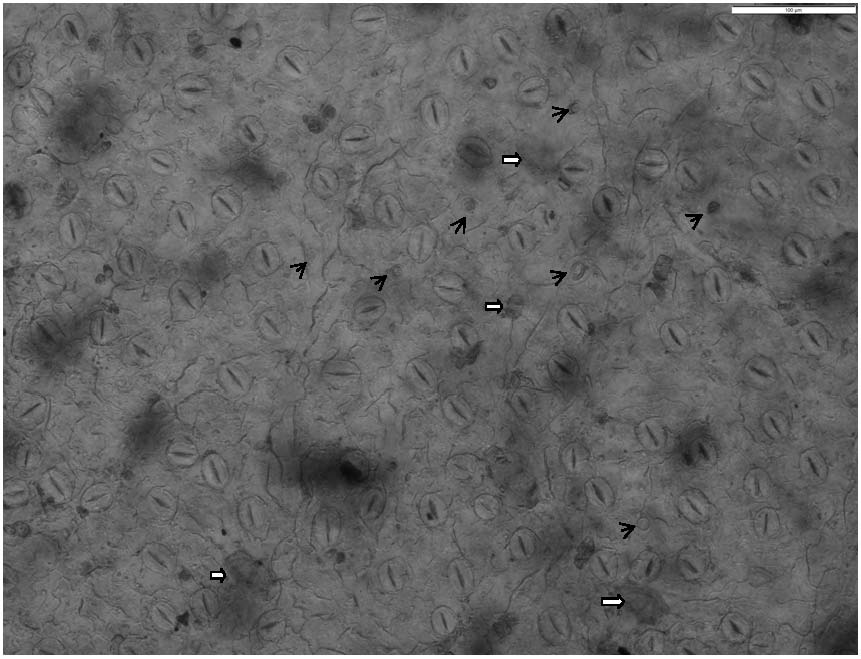 Microscopic slide preparation method for observing characteristics of lower epidermis of folium artemisiae argyi