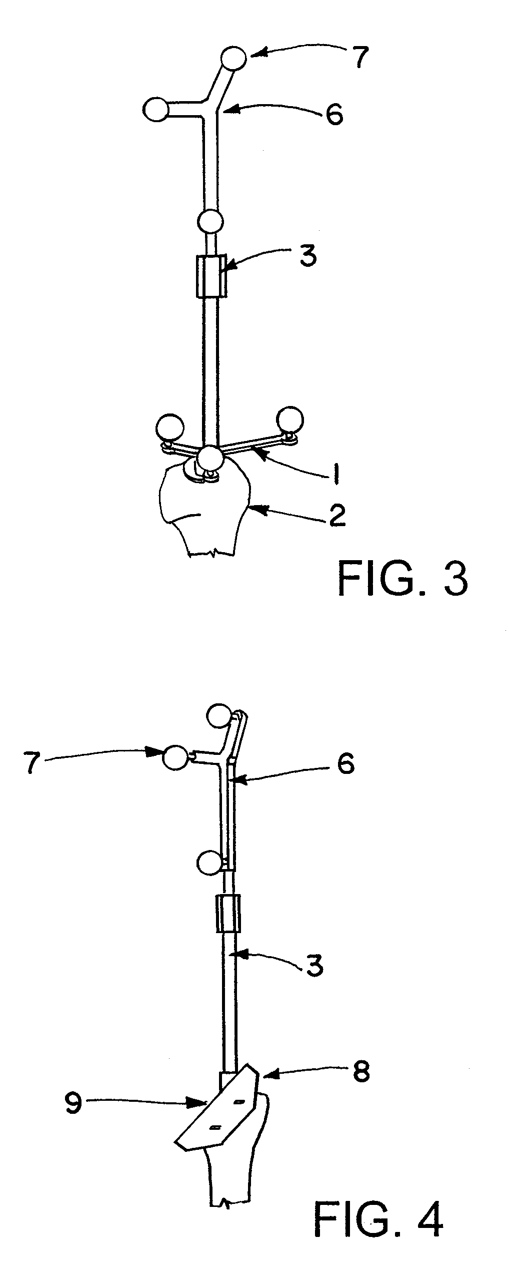 System for navigation-assisted shoulder operations and navigation method for positioning navigated treatment apparatuses with respect to a bone