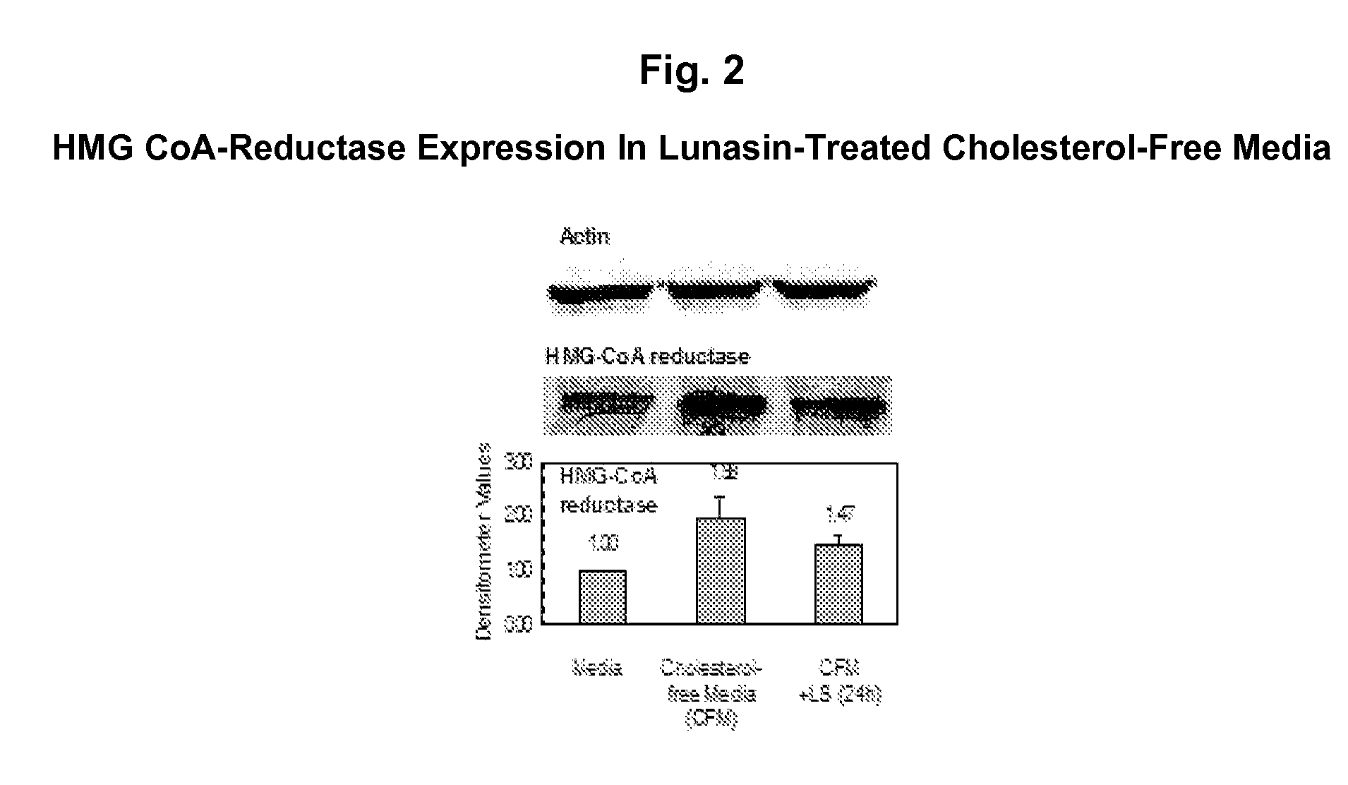 Methods for using soy peptides to inhibit H3 acetylation, reduce expression of HMG CoA reductase, and increase LDL receptor and Sp1 expression in a mammal